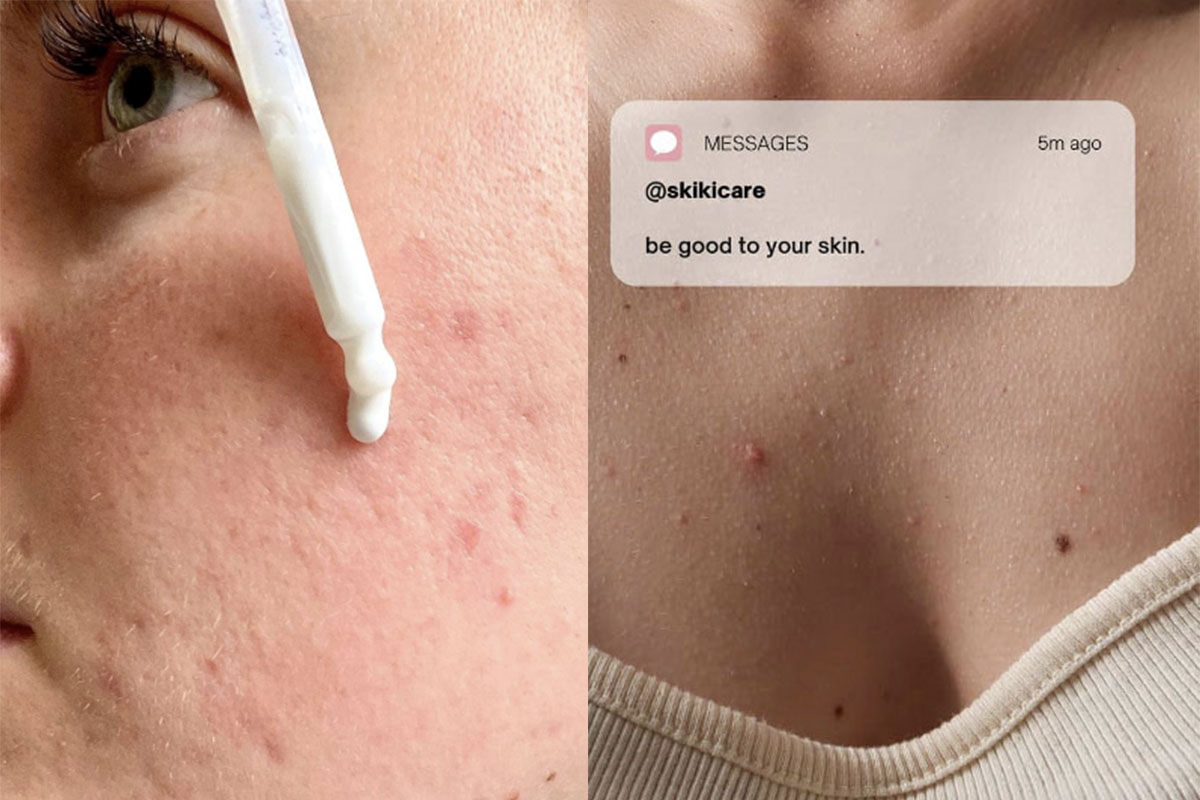 Skin positive: el movimiento que busca cuidar y amar nuestra piel