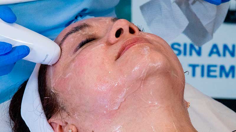 liftera lifting facial no invasivo